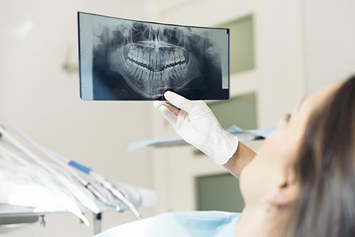 dental-x-rays